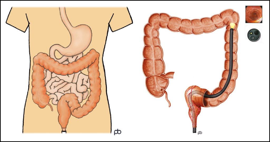 Images of large intestine