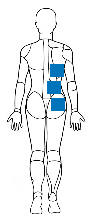 Image showing different positions of IPG’s