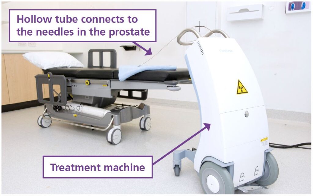 An image with labels showing the treatment room and equipment.