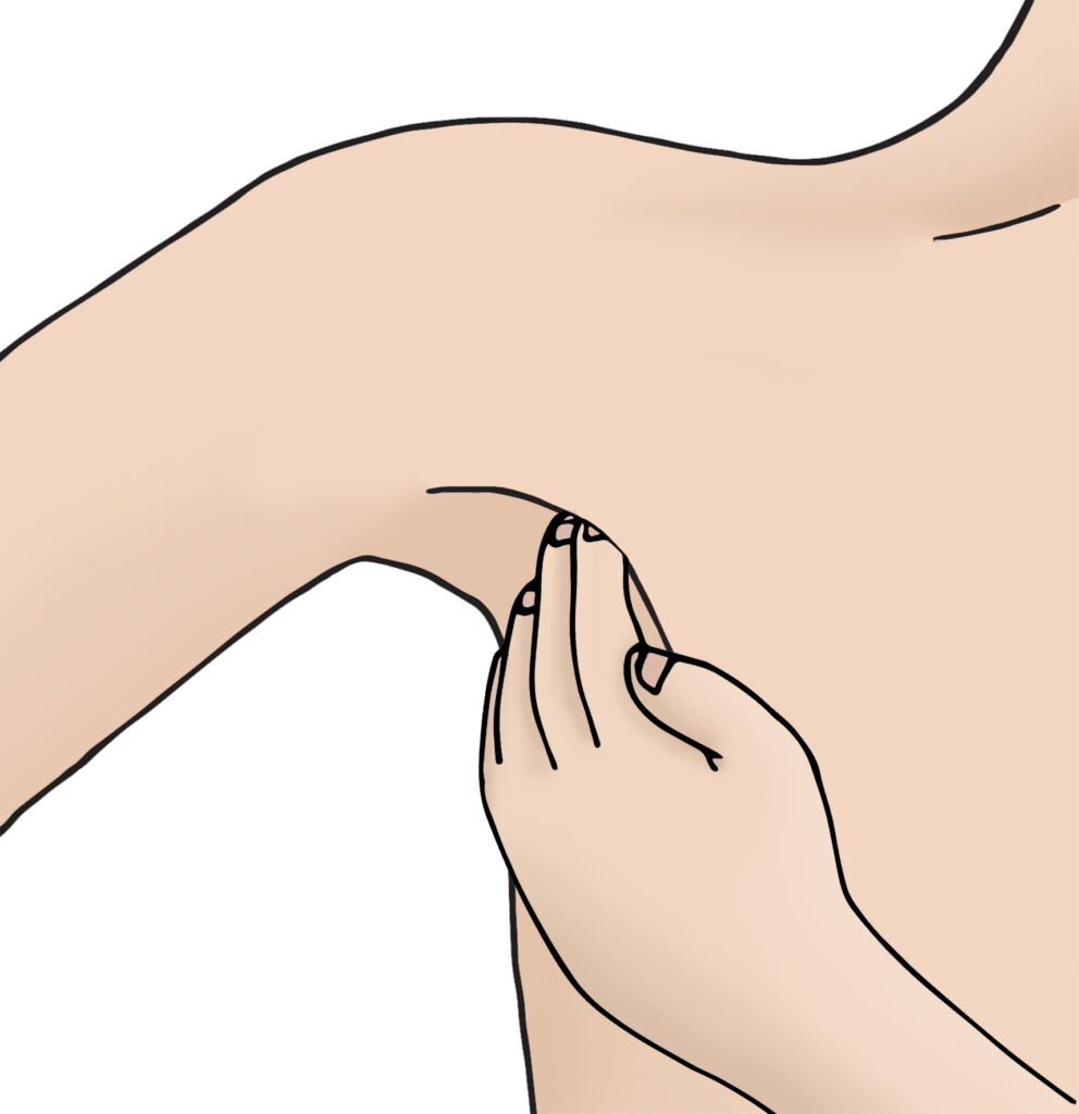 Illustration of a close up of a person checking for lymph nodes on the armpit area