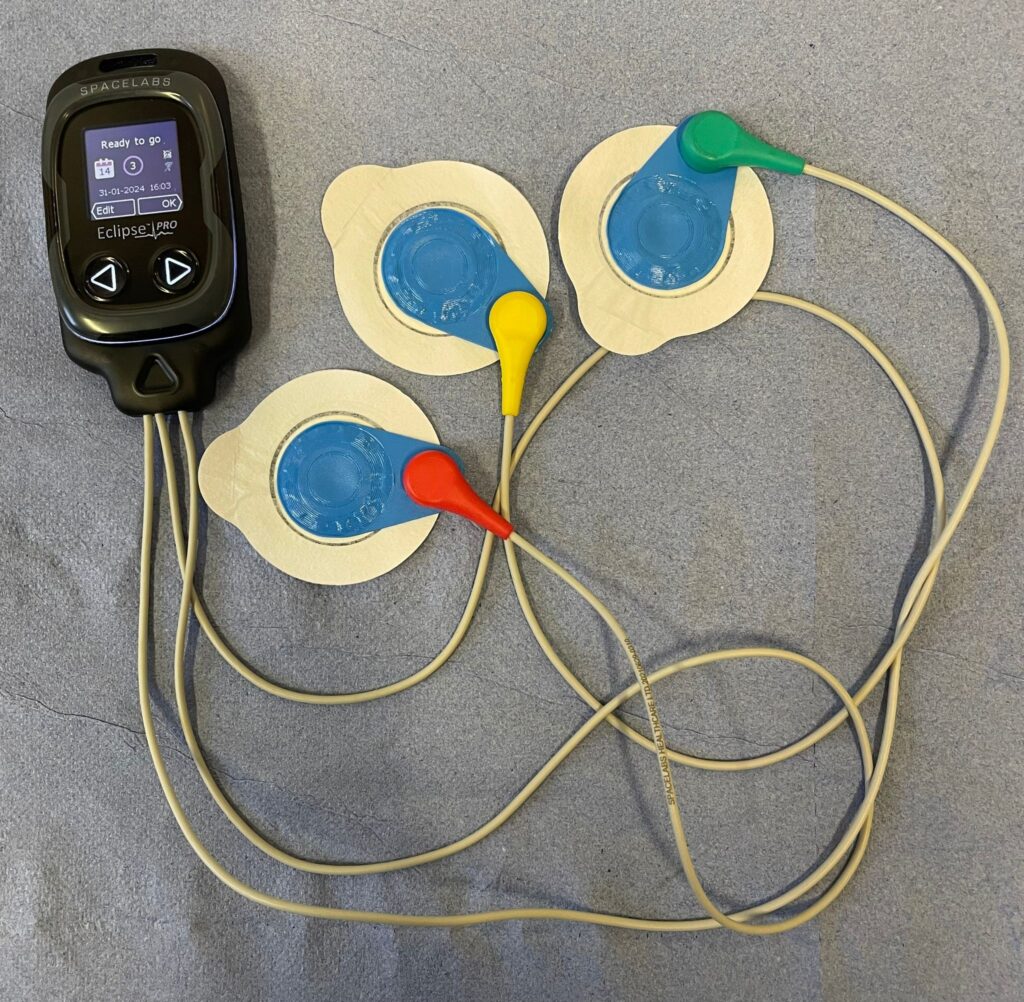 Photograph one of a ambulatory ECG monitor