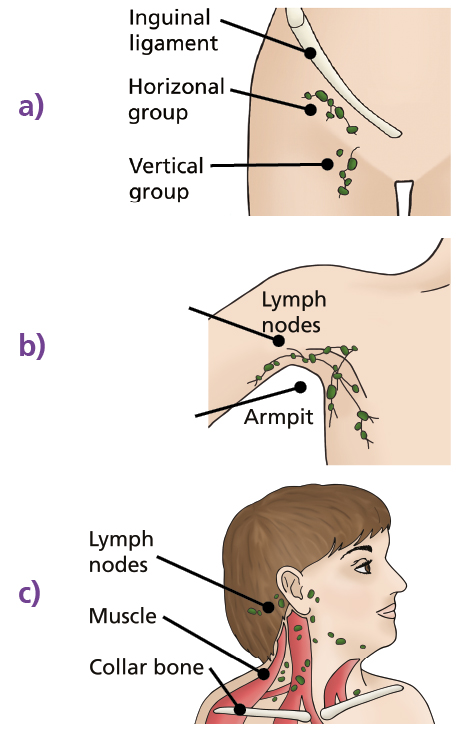 a, Illustration of the groin area showing the inguinal ligament and position of horizonal and vertical groups of lymph nodes. b, Illustration of the armpit showing the position of lymph nodes. c, Illustration of the head, neck and shoulders showing the position of lymph nodes as well as muscles and collar bone