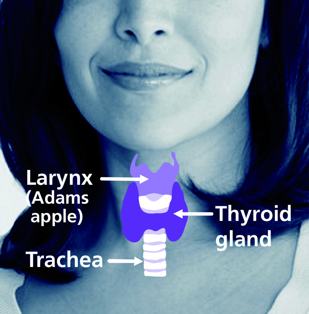 Photograph of a persons neck with a illustration over the top of a diagram showing the larynx, thyroid gland and trachea