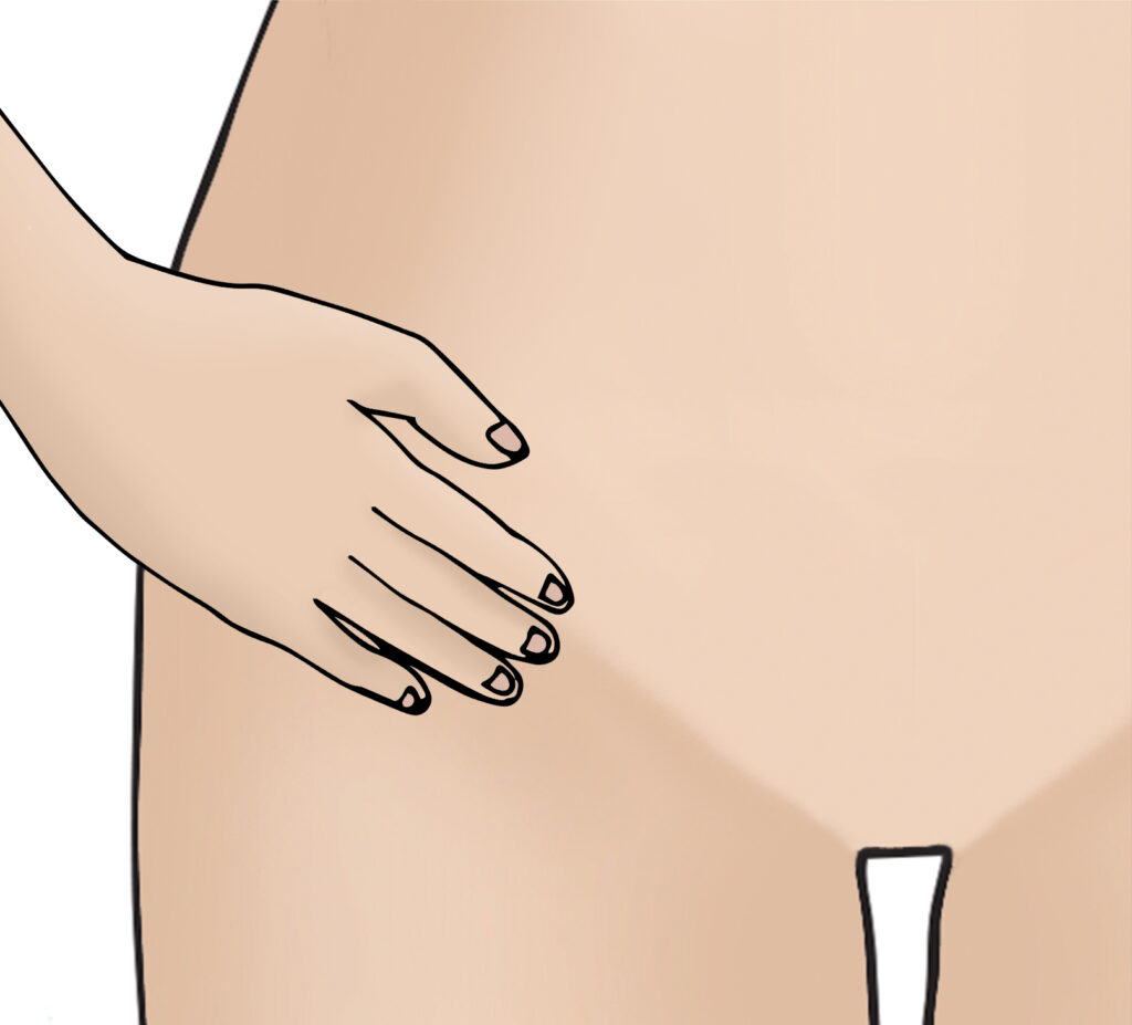 Illustration of a close up of a person checking for lymph nodes on the groin area