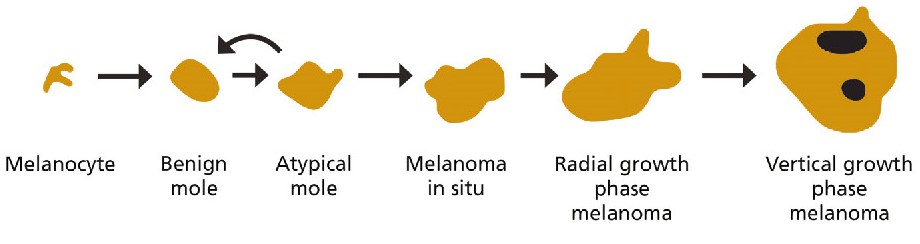 An image showing the different stages of mole growth