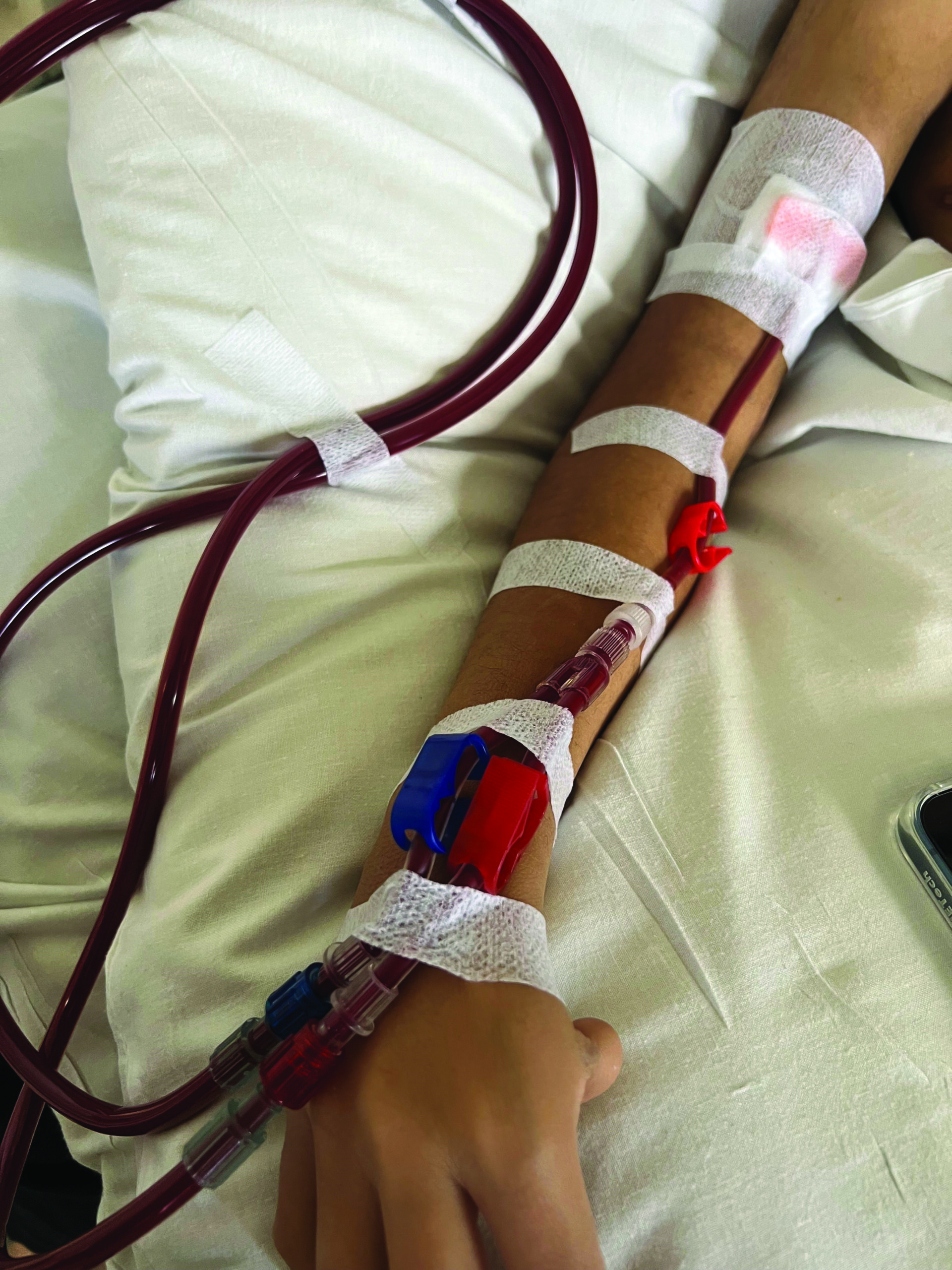 Dialysis Options: What happens next? - Leeds Teaching Hospitals NHS Trust