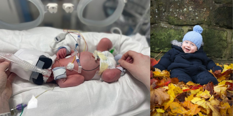 Two photos of baby Louie - the first he is in an incubator shortly after he was born and the second he at home sat in a navy winter outfit and blue hat laughing sat in some orange autumnal leaves.