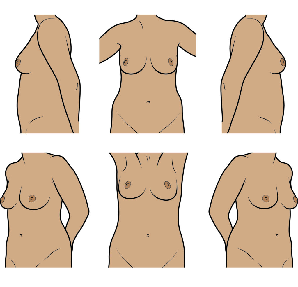 Illustration of the different angles of the body needed for breast photography.