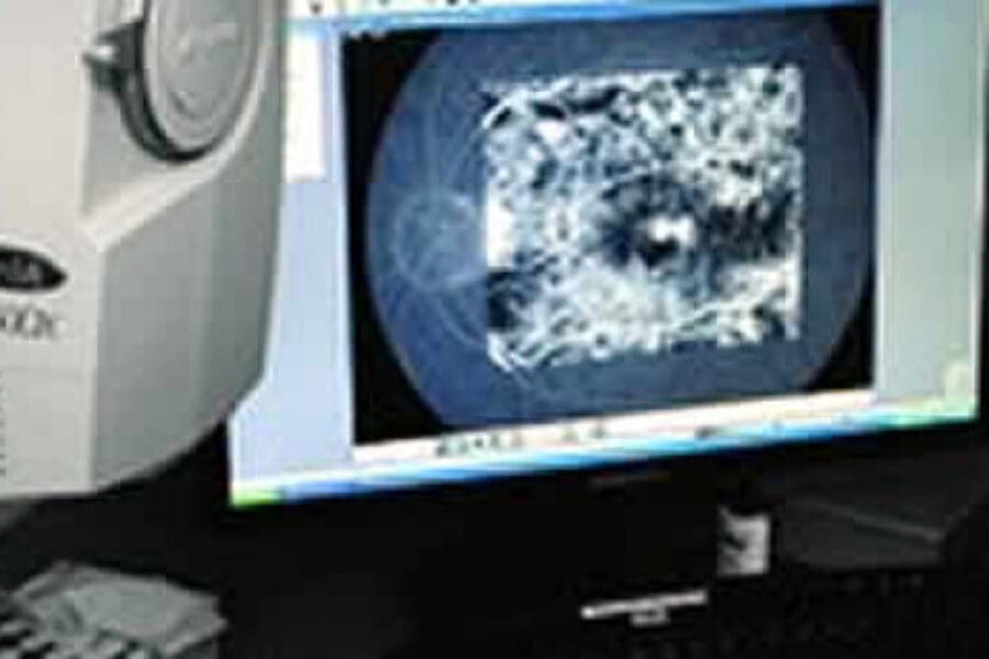 ophthalmic-imaging-header__ScaleWidthWzEwMDBd